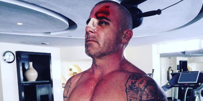 Syuting Prison Break, Dominic Purcell Bonyok