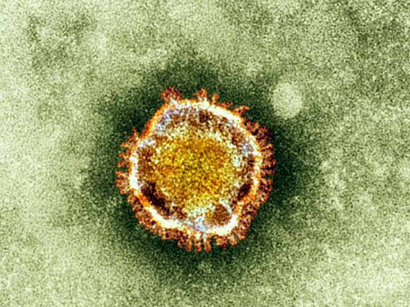 Alert! Muncul Virus Yang Lebih Berbahaya Dari SARS! thumbnail